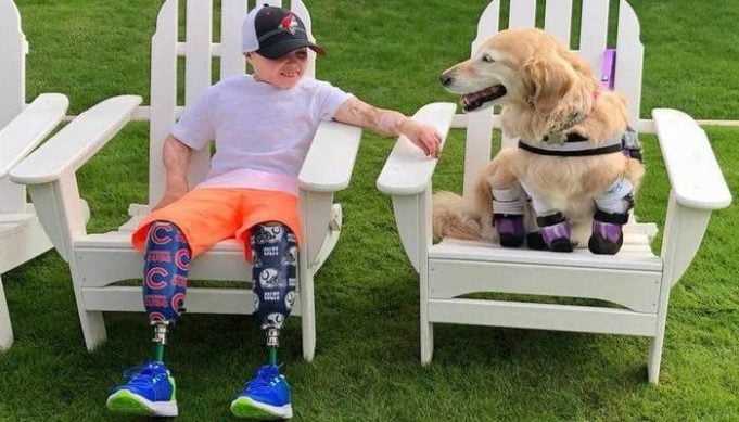 Boy Amputee Meets Dog Amputee and It’s Love