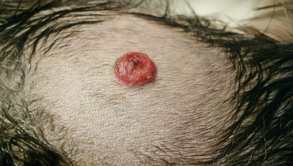 Hemangiosarcoma In Dogs