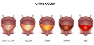 Dog urine color chart