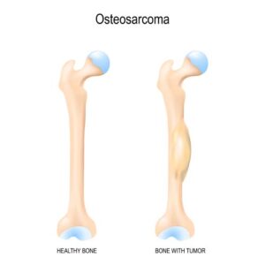 How Does Osteosarcoma in Dogs Grow