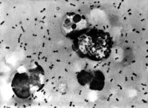 Yersinia pestis bacteria which caused Bubonic Plague