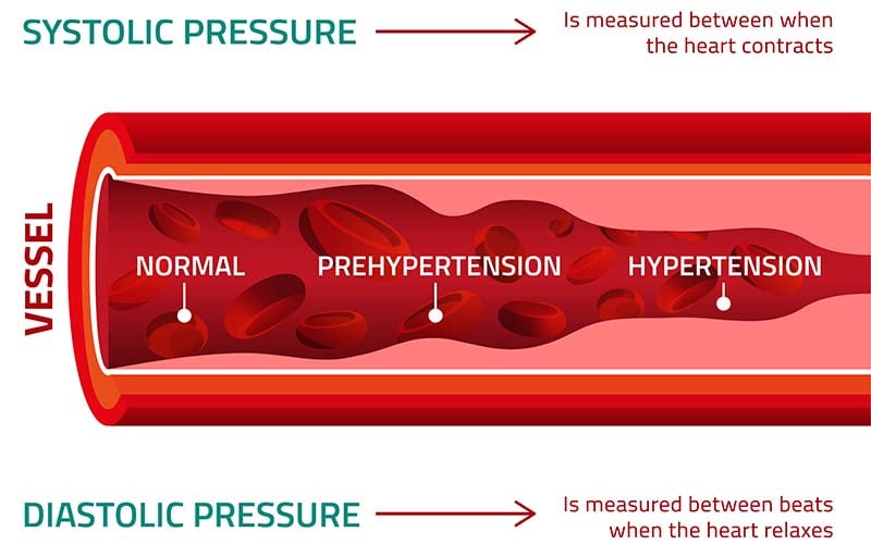 Blood pressure measuring