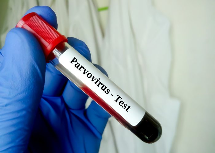 A blood sample in a vial for parvovirus test